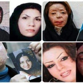 ‘Bad hijab’ Prompts Acid Attacks On Women in Iran